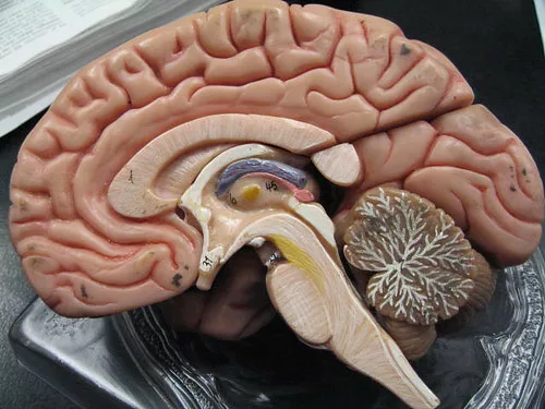 Sezione di un cervello umano